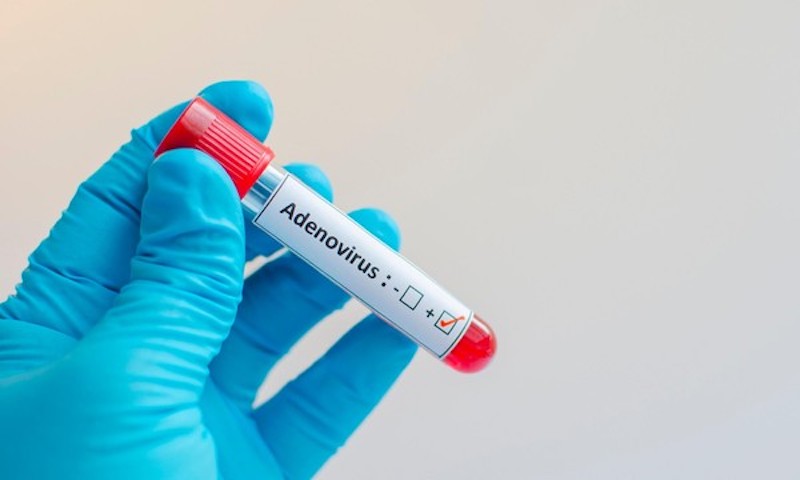 Adenovirus tiếp tục chạm mốc hơn 1.400 ca, 7 trẻ tử vong: Cha mẹ cần phân biệt rõ với bệnh hô hấp thông thường - Ảnh 2. Adenovirus tiếp tục chạm mốc hơn 1.400 ca, 7 trẻ tử vong: Cha mẹ cần phân biệt rõ với bệnh hô hấp thông thường - Ảnh 2.