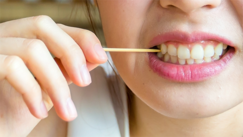 Chuyên gia cảnh báo những tác hại khôn lường khi dùng tăm xỉa răng: Nhẹ thì rách mô nướu, nặng thì gây nhiễm trùng, phá vỡ thủ thuật nha khoa - Ảnh 2.