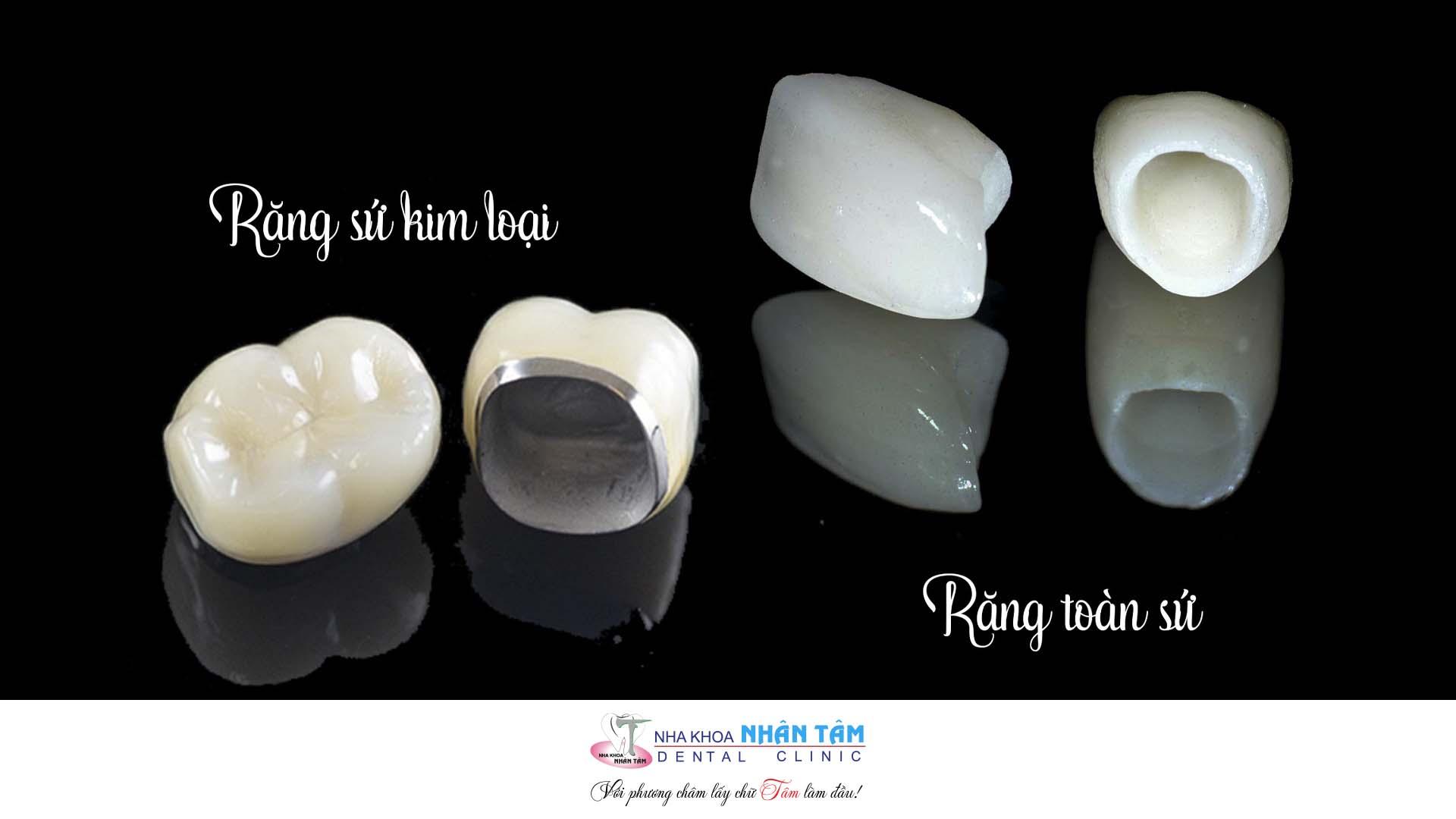 Chinh phục nụ cười hoàn mỹ với phương pháp trồng răng sứ - Ảnh 1. Chinh phục nụ cười hoàn mỹ với phương pháp trồng răng sứ - Ảnh 1.