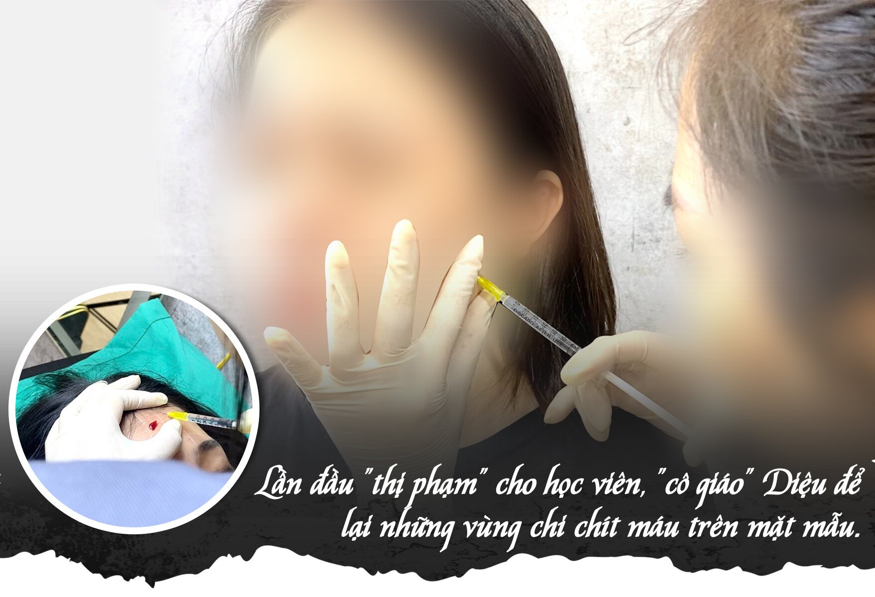 Trong ‘lò’ đào tạo tiêm filler chui: Hãi hùng bị ép tiêm sau 1 giờ học việc - Ảnh 8.