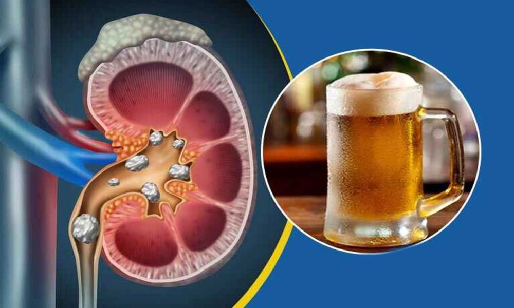 Những người có thận khỏe thường có 6 đặc điểm này khi ăn uống: Nếu đủ cả thì xin chúc mừng! - Ảnh 6. Những người có thận khỏe thường có 6 đặc điểm này khi ăn uống: Nếu đủ cả thì xin chúc mừng! - Ảnh 6.