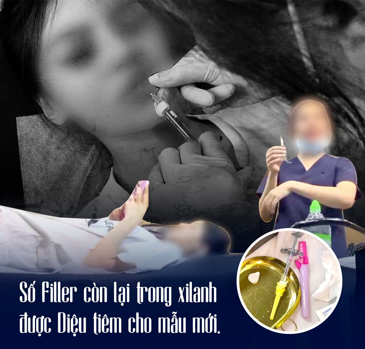 Trong ‘lò’ đào tạo tiêm filler chui: ‘Mình tiêm gì lên mặt nó sao nó biết mà lo’ - Ảnh 8.