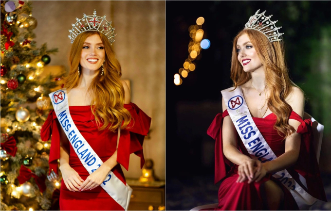 Từng bị bắt nạt vì ngoại hình kém xinh, cô gái "lột xác" ngoạn mục trở thành "nữ hoàng sắc đẹp"&nbsp;nước Anh - Ảnh 3.