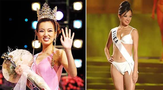Hoa hậu Hàn Quốc chi gần 15 tỷ đồng phẫu thuật thẩm mỹ toàn thân, kéo dài chân thêm 20cm từ 1m5 thành 1m7? - Ảnh 3.
