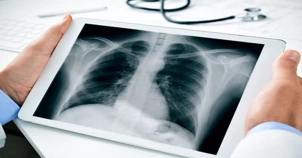  2 yếu tố gây tổn thương phổi, ung thư gần kề quẩn quanh người Việt, cái số 1 nhiều người thích mê  - Ảnh 1.