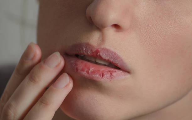 1 dấu hiệu ở miệng có thể cảnh báo 5 bệnh nghiêm trọng - Ảnh 2.