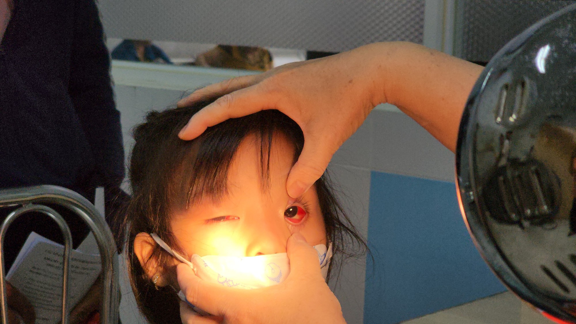 Bệnh viện Nhi đồng 2: Hàng chục ca đau mắt đỏ đến khám mỗi ngày - Ảnh 2.