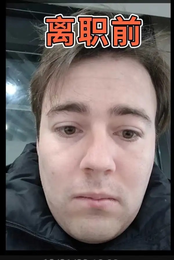 Hí hửng đến Trung Quốc làm việc, người đàn ông bị 996 "đày đọa tàn tạ": Mặt giờ như biến thành người khác- Ảnh 3.