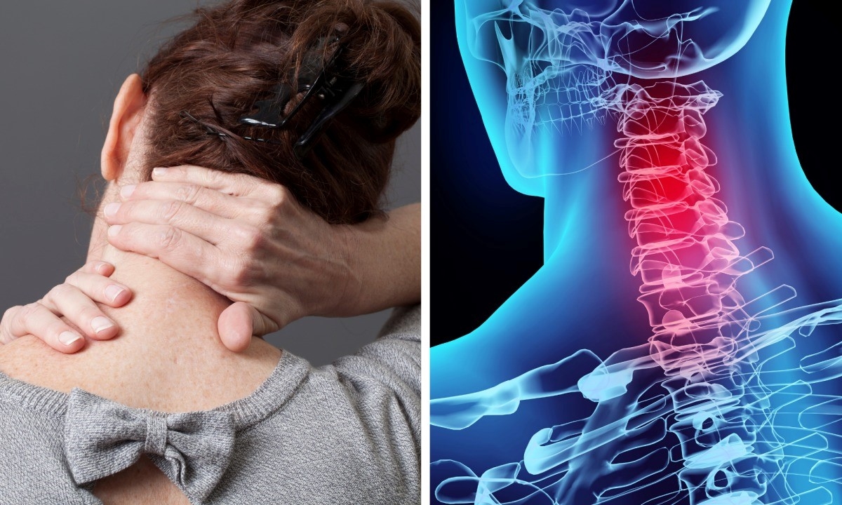 Hậu quả khôn lường từ thói quên bẻ, lắc cổ nhưng không phải ai cũng biết- Ảnh 1.