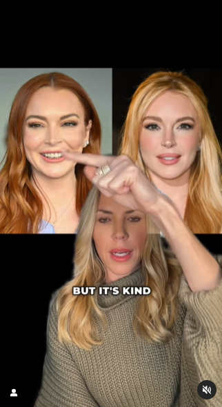 Bí ẩn của "thần dược cải lão hoàn đồng": Cách Lindsay Lohan và loạt sao Hollywood sử dụng để cứu vớt nhan sắc tới ngày "cận date"?- Ảnh 7.