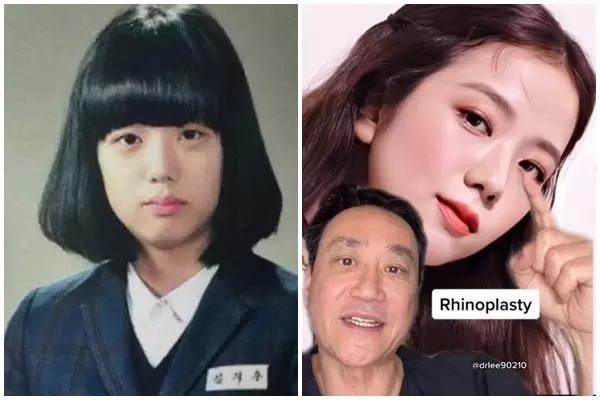 Sao nữ đẹp nhất thế giới năm 2024: Lần thứ 3 liên tiếp giành ngôi vị đầu bảng, bí mật về can thiệp "dao kéo" được bác sĩ tiết lộ- Ảnh 4.