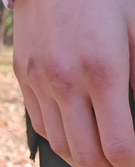 Cô bé thần đồng từng gây sốc khi tung 654 cú đấm trong một phút và đánh ngã cả cây, hiện tại giờ ra sao?- Ảnh 7. Cô bé thần đồng từng gây sốc khi tung 654 cú đấm trong một phút và đánh ngã cả cây, hiện tại giờ ra sao?- Ảnh 7.