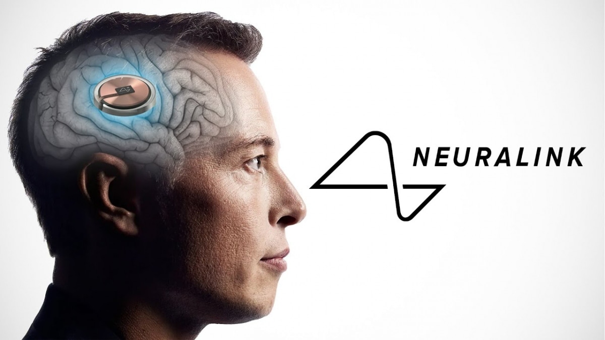 Người đầu tiên được cấy chip não Neuralink đã hồi phục, còn được bổ sung thêm "siêu năng lực" mới- Ảnh 1. Người đầu tiên được cấy chip não Neuralink đã hồi phục, còn được bổ sung thêm "siêu năng lực" mới- Ảnh 1.