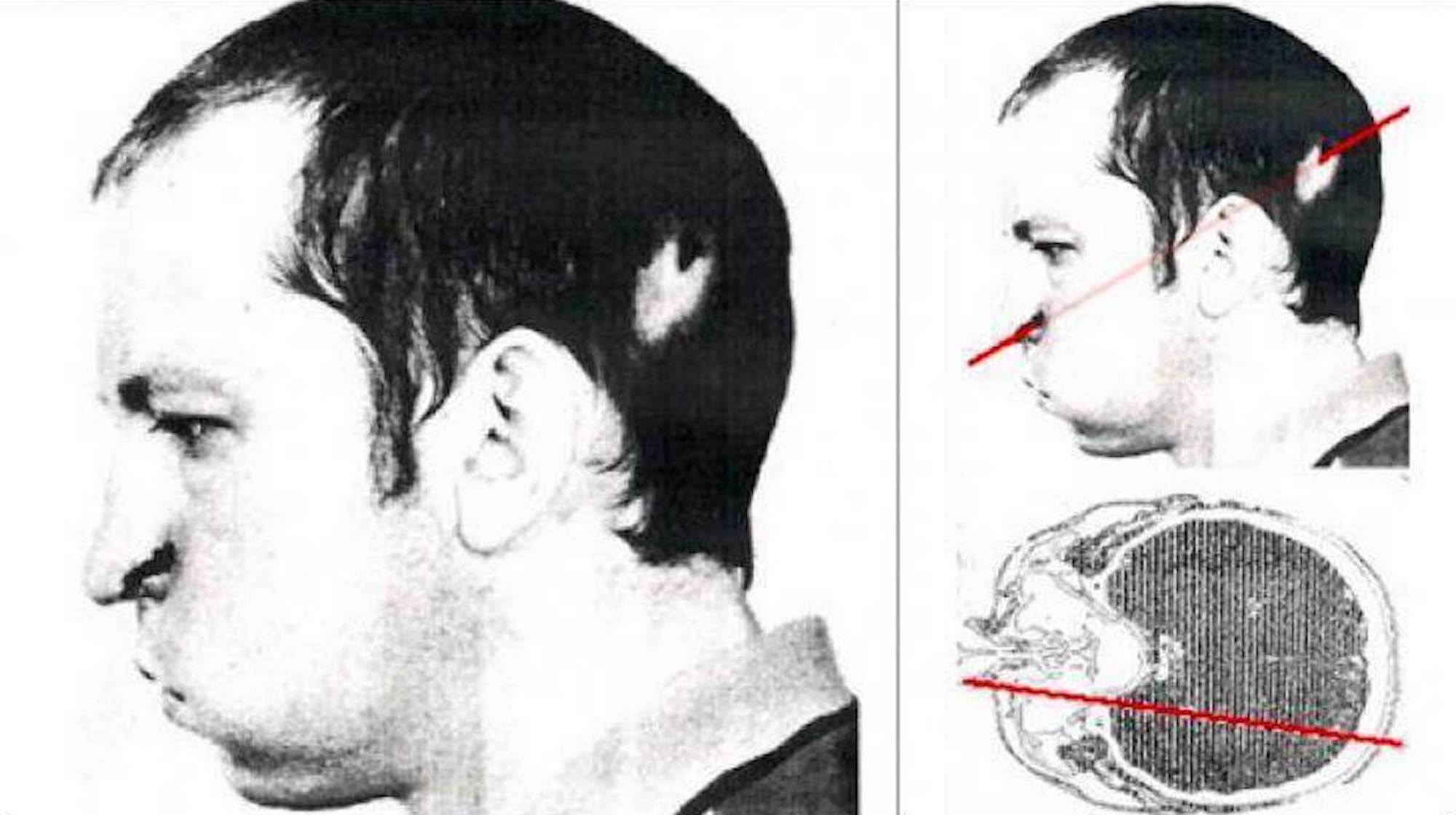 Câu chuyện kỳ lạ về Anatoli Bugorski: Người đàn ông bị kẹt đầu trong máy gia tốc proton và sống sót để kể câu chuyện- Ảnh 1. Câu chuyện kỳ lạ về Anatoli Bugorski: Người đàn ông bị kẹt đầu trong máy gia tốc proton và sống sót để kể câu chuyện- Ảnh 1.