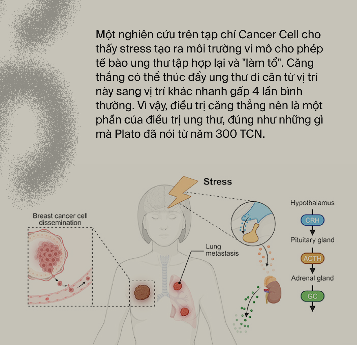 Ai đã &quot;phát minh&quot; ra stress: Tác nhân của 80% bệnh tật trên đời, bao gồm cả ung thư?- Ảnh 2.