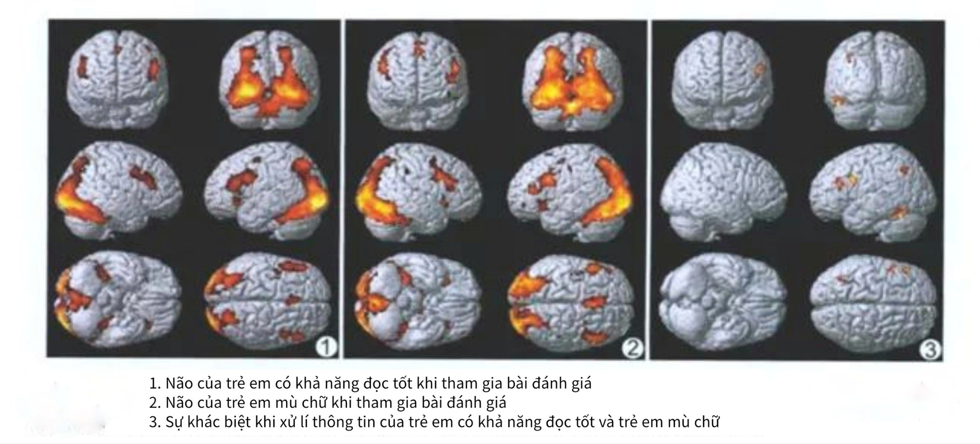 Bộ não của trẻ chăm chỉ đọc với không đọc có sự khác biệt cực lớn: Không lưu ý, 10 năm sau cha mẹ mới ngỡ ngàng- Ảnh 1. Bộ não của trẻ chăm chỉ đọc với không đọc có sự khác biệt cực lớn: Không lưu ý, 10 năm sau cha mẹ mới ngỡ ngàng- Ảnh 1.