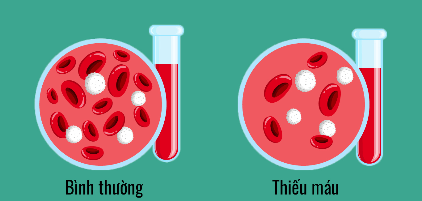 4 dấu hiệu cho thấy thận bắt đầu suy hỏng: Có 1 cũng cần đi khám ngay- Ảnh 1. 4 dấu hiệu cho thấy thận bắt đầu suy hỏng: Có 1 cũng cần đi khám ngay- Ảnh 1.