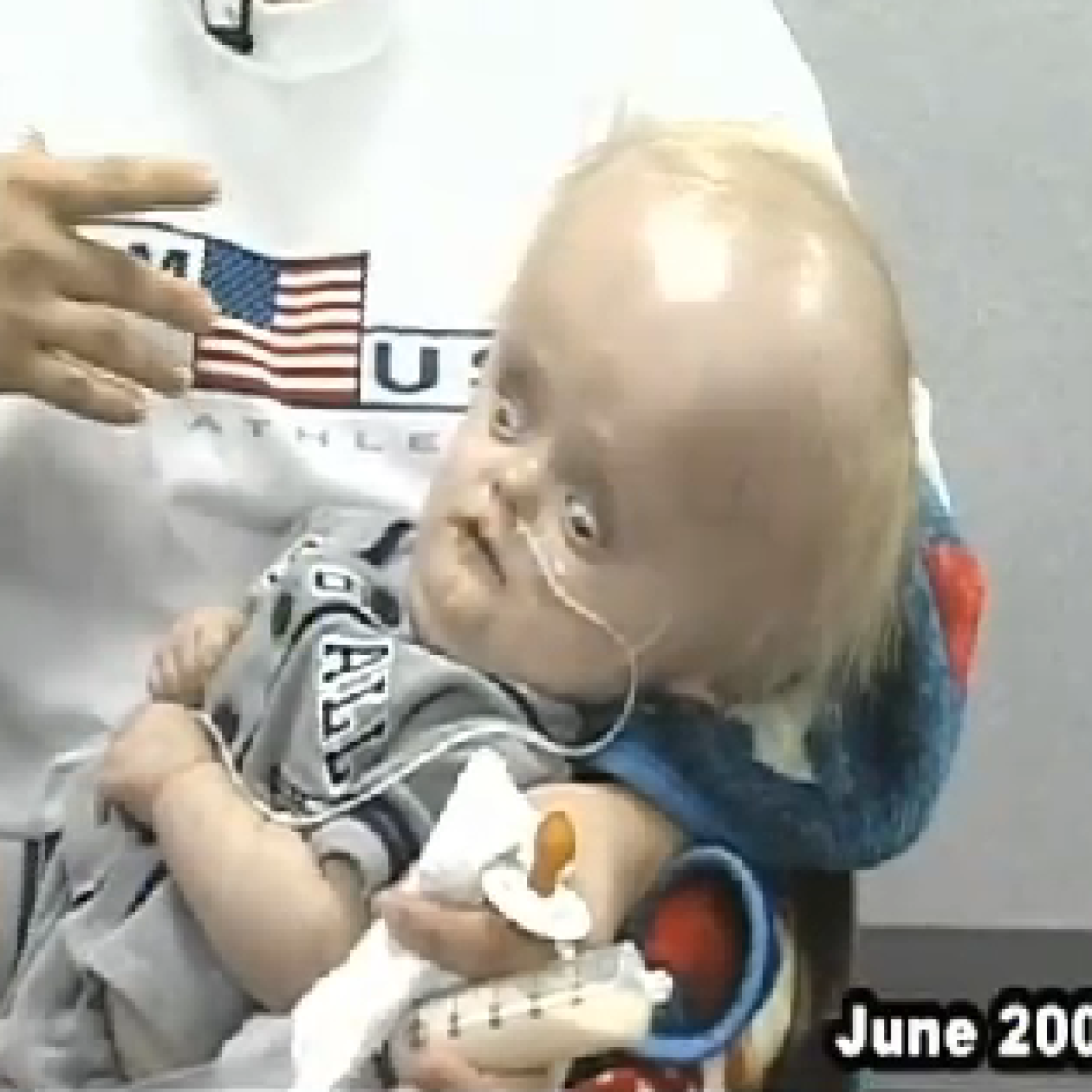 Kinh ngạc phát hiện người đàn ông gần như không có não, trong khoang sọ chỉ toàn chất lỏng vẫn sống bình thường: Nguyên nhân vì sao?- Ảnh 2.