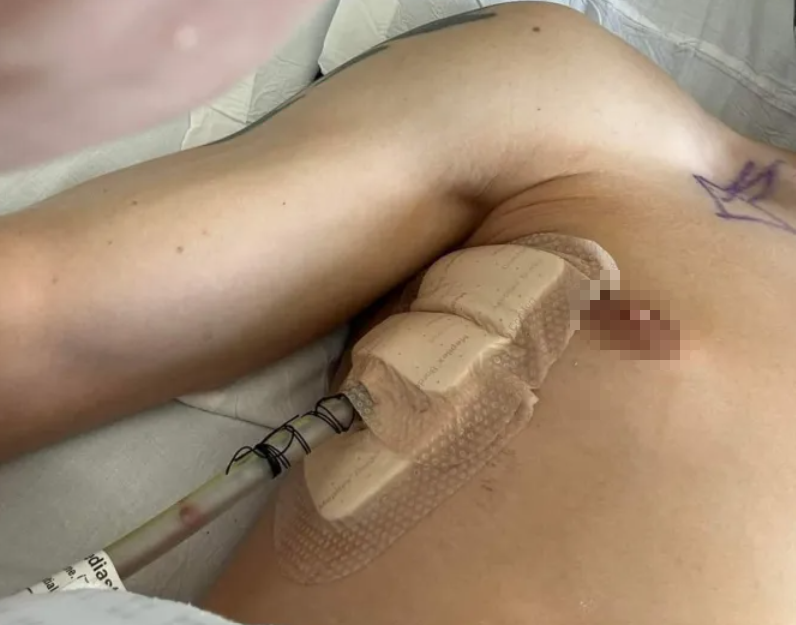 Thanh niên 29 tuổi đang khỏe bỗng ngã quỵ, ngực đau như bị đâm: Bác sĩ nói do 1 thói quen cực có hại - Ảnh 2. Thanh niên 29 tuổi đang khỏe bỗng ngã quỵ, ngực đau như bị đâm: Bác sĩ nói do 1 thói quen cực có hại - Ảnh 2.