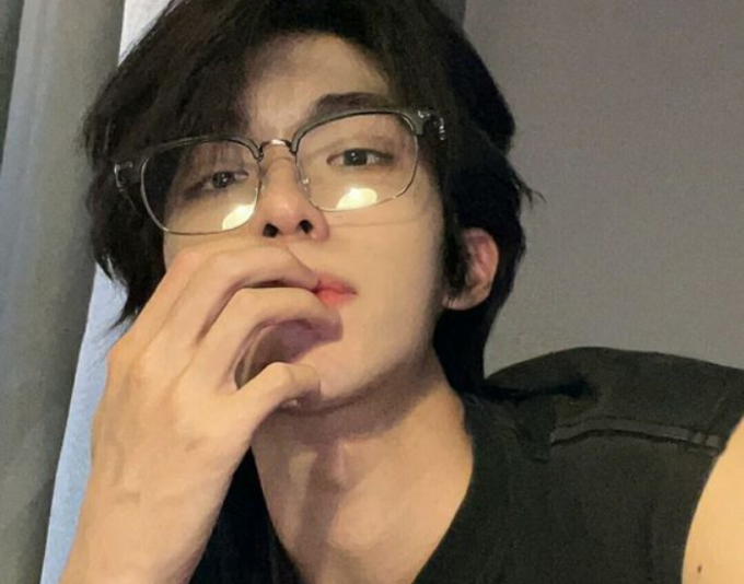 “1 sưng, 2 đen” trên khuôn mặt cho thấy thận kiệt quệ vì bệnh tật- Ảnh 2. “1 sưng, 2 đen” trên khuôn mặt cho thấy thận kiệt quệ vì bệnh tật- Ảnh 2.