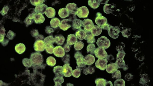 100% người nhiễm virus 'ăn não' Amip tử vong, sắp có phương pháp điều trị mới đầy hi vọng- Ảnh 2. 100% người nhiễm virus 'ăn não' Amip tử vong, sắp có phương pháp điều trị mới đầy hi vọng- Ảnh 2.