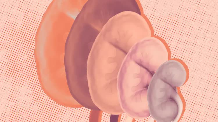 Thận suy hỏng nhanh hơn nếu uống quá nhiều 3 loại nước này- Ảnh 2. Thận suy hỏng nhanh hơn nếu uống quá nhiều 3 loại nước này- Ảnh 2.