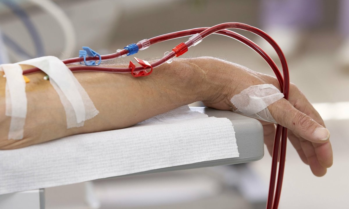 Người đàn ông Hà Nội suy thận ở tuổi 34: "Giá như đi khám sớm thì đã không phải chạy thận suốt đời"- Ảnh 1. Người đàn ông Hà Nội suy thận ở tuổi 34: "Giá như đi khám sớm thì đã không phải chạy thận suốt đời"- Ảnh 1.