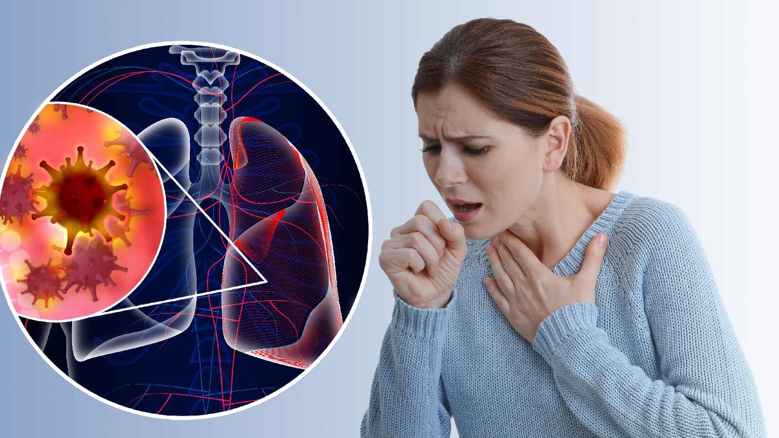 Người phụ nữ sốc khi phát hiện mắc ung thư phổi di căn: Người phụ nữ sốc khi phát hiện mắc ung thư phổi di căn: