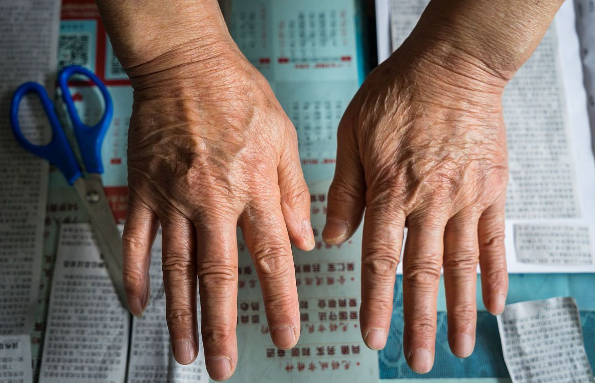 Nhìn tay đoán tuổi thọ: Người sống lâu thường có những đặc điểm này, nếu bạn có trên 2 điều thì xin chúc mừng- Ảnh 3. Nhìn tay đoán tuổi thọ: Người sống lâu thường có những đặc điểm này, nếu bạn có trên 2 điều thì xin chúc mừng- Ảnh 3.