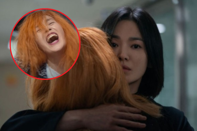 Nữ diễn viên "The Glory" qua đời vì nhồi máu não: Cảnh báo 3 dấu hiệu phải đi cấp cứu ngay- Ảnh 2.