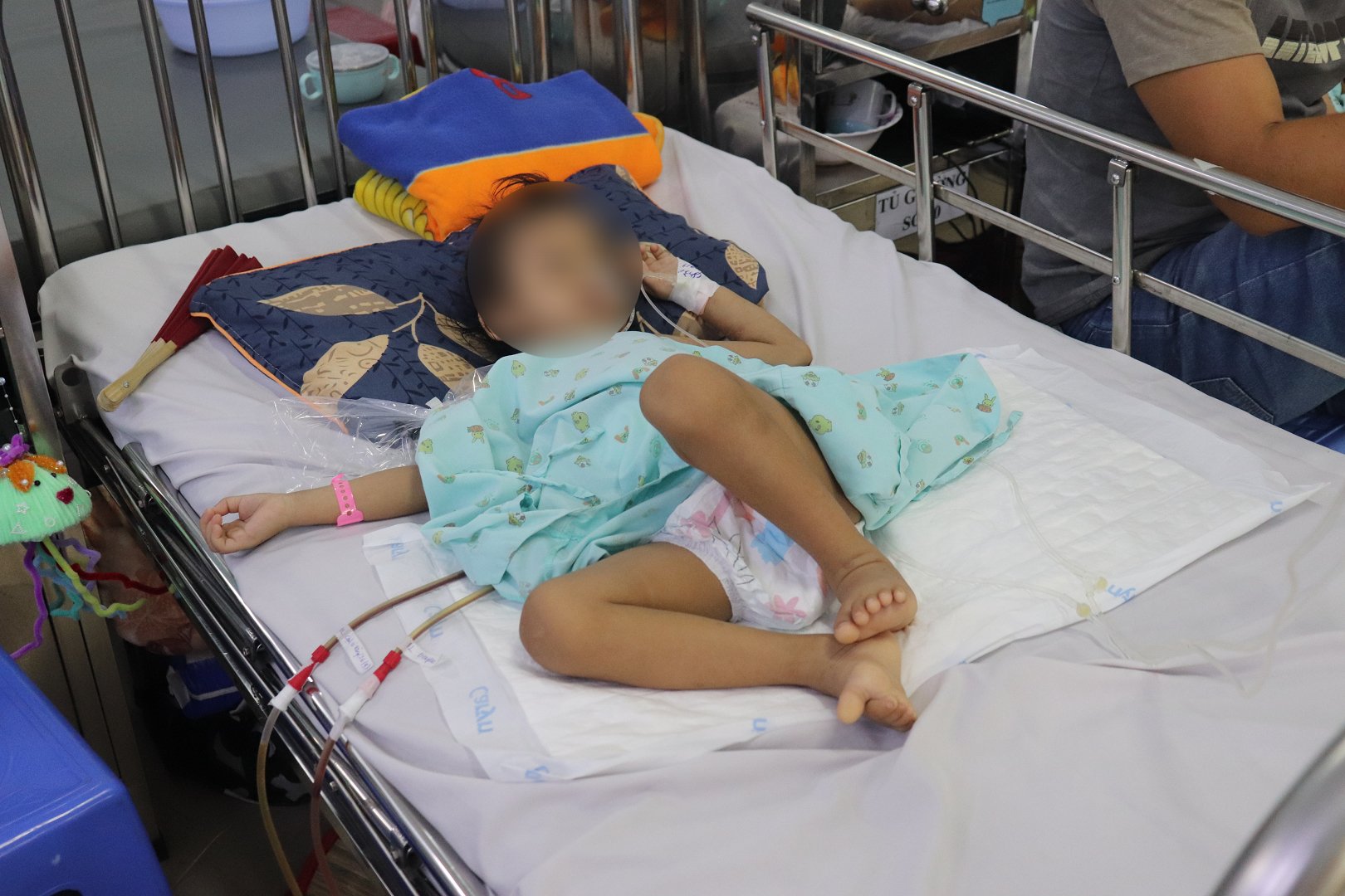 Hy hữu nhành cây dài 16 cm nằm trong bụng bé gái suốt 4 tháng Hy hữu nhành cây dài 16 cm nằm trong bụng bé gái suốt 4 tháng