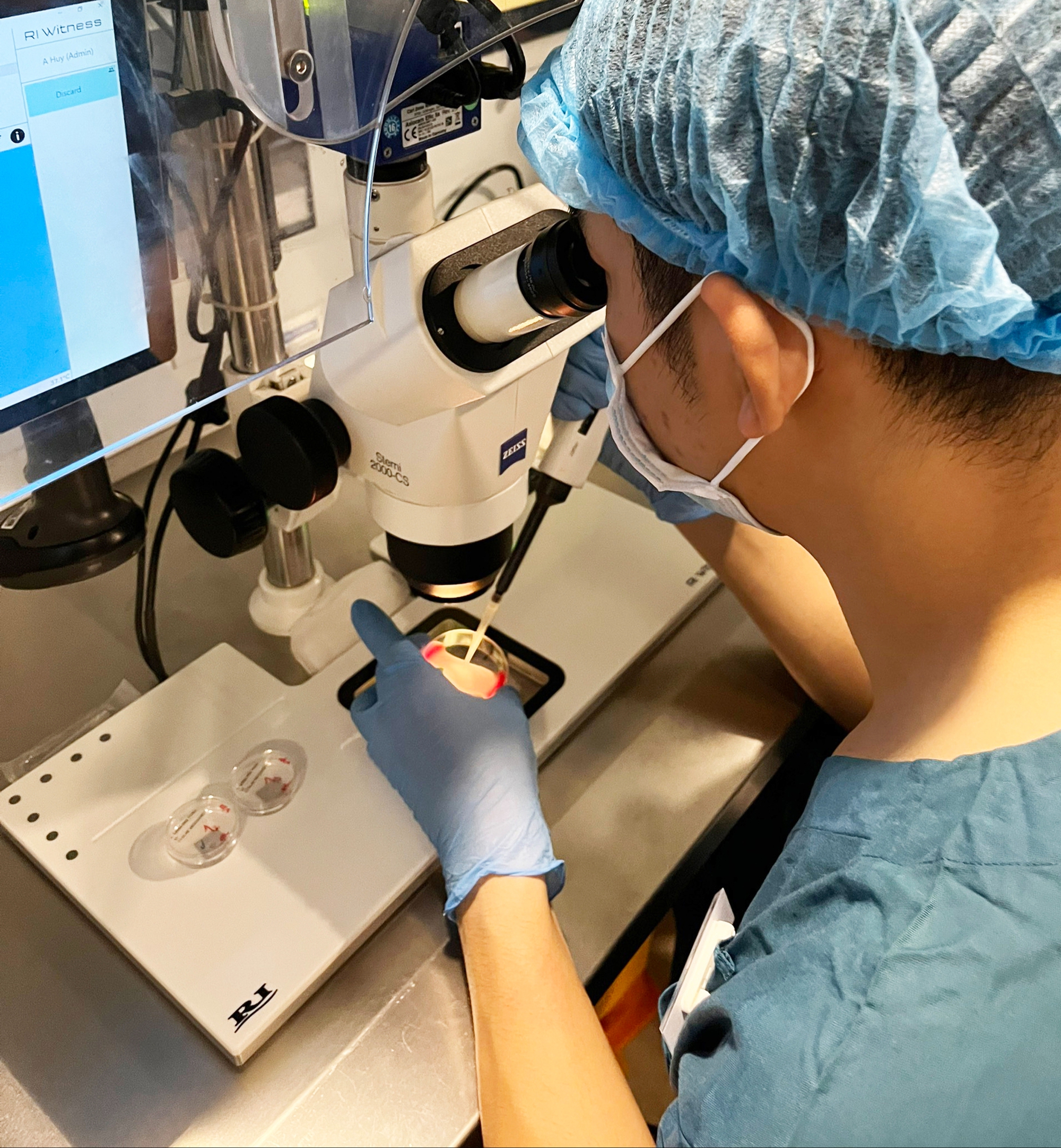 Bước ngoặt trong điều trị hiếm muộn không cần kích trứng- Ảnh 4. Bước ngoặt trong điều trị hiếm muộn không cần kích trứng- Ảnh 4.