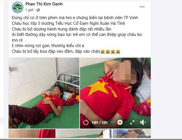 Xác minh thông tin bé gái lớp 5 bị cha dượng bạo hành - Ảnh 4.