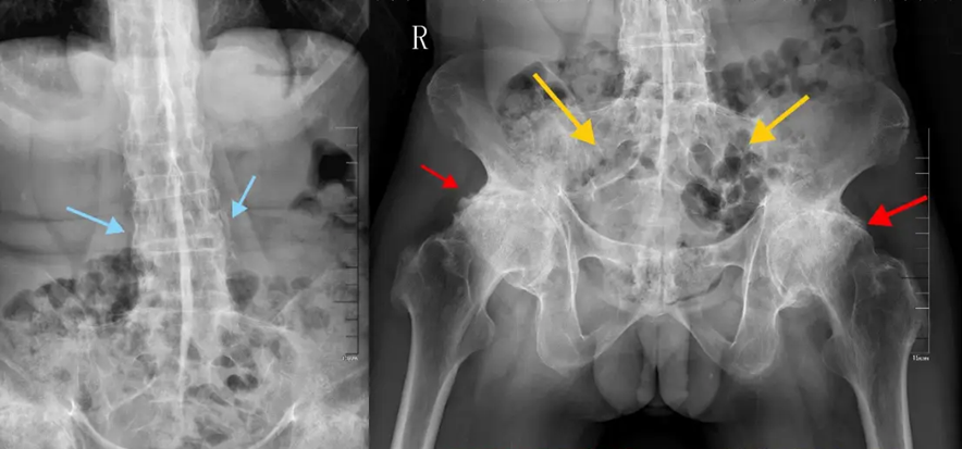Bệnh tật 20 năm của Châu Kiệt Luân đang tấn công giới trẻ!- Ảnh 2.