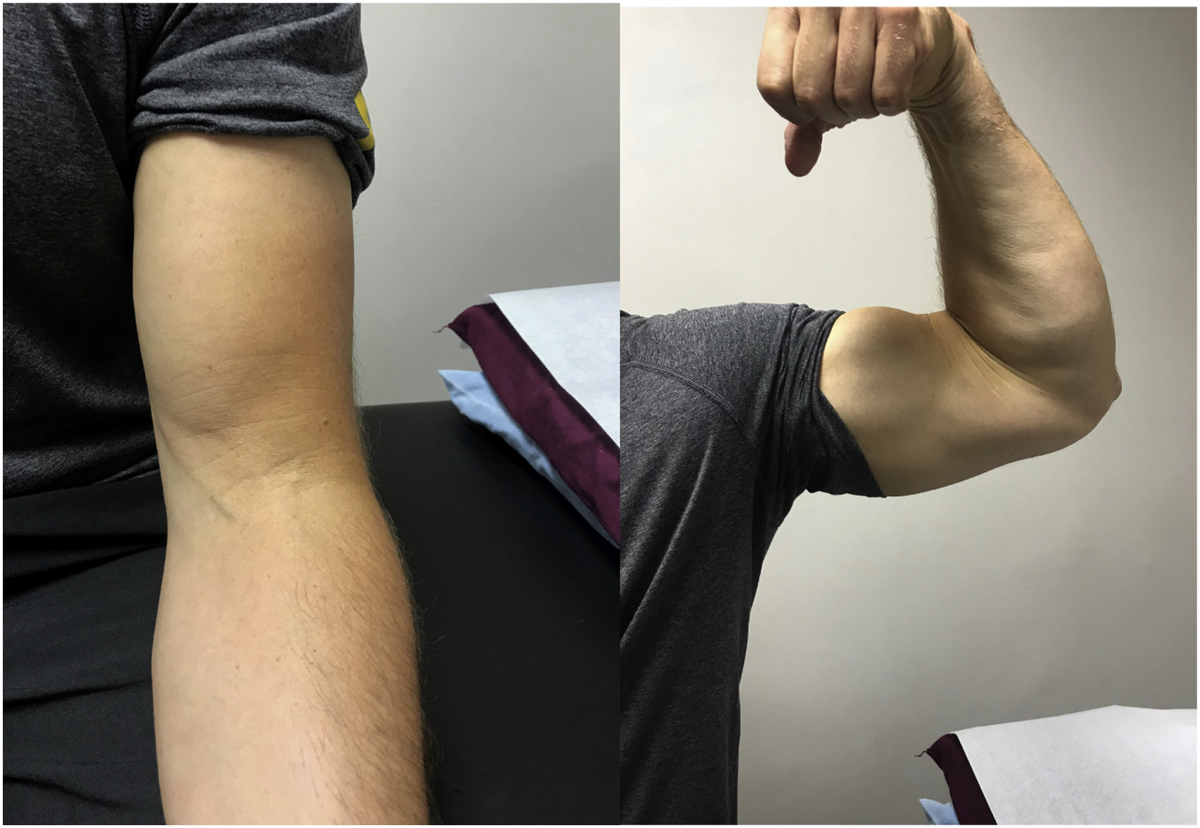 3 thay đổi về cân nặng rất có thể là DẤU HIỆU UNG THƯ, cái đầu tiên nhiều người mừng hơn là sợ - Ảnh 3.