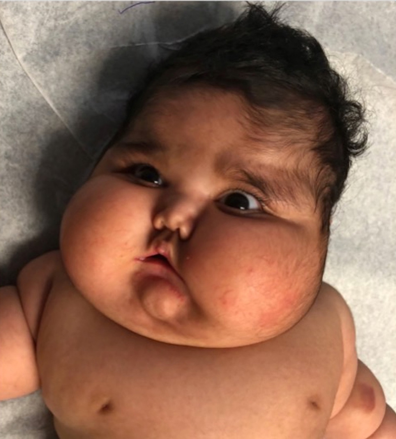 Ngày càng nhiều trẻ bị tác dụng phụ do dùng thuốc chứa corticoid: Dược sĩ chỉ rõ cách nhận biết corticoid trong đơn thuốc của con- Ảnh 2.