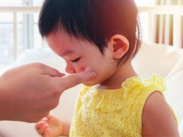 Ngày càng nhiều trẻ bị tác dụng phụ do dùng thuốc chứa corticoid: Dược sĩ chỉ rõ cách nhận biết corticoid trong đơn thuốc của con- Ảnh 3.