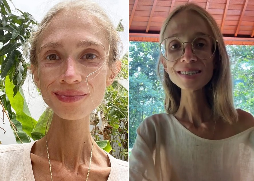 8 năm chỉ ăn trái cây, cô gái 27 tuổi qua đời: Sự thật được "phơi bày" - Ảnh 4. 8 năm chỉ ăn trái cây, cô gái 27 tuổi qua đời: Sự thật được "phơi bày" - Ảnh 4.