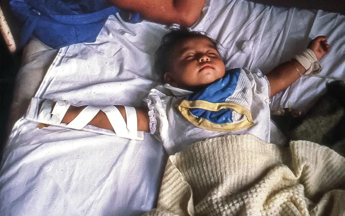 Gia tăng số ca mắc tả tại hơn 30 quốc gia, WHO cảnh báo về nguy cơ lan rộng - Ảnh 1.