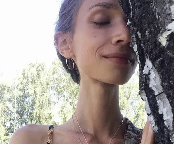 8 năm chỉ ăn trái cây, cô gái 27 tuổi qua đời: Sự thật được "phơi bày" - Ảnh 1. 8 năm chỉ ăn trái cây, cô gái 27 tuổi qua đời: Sự thật được "phơi bày" - Ảnh 1.