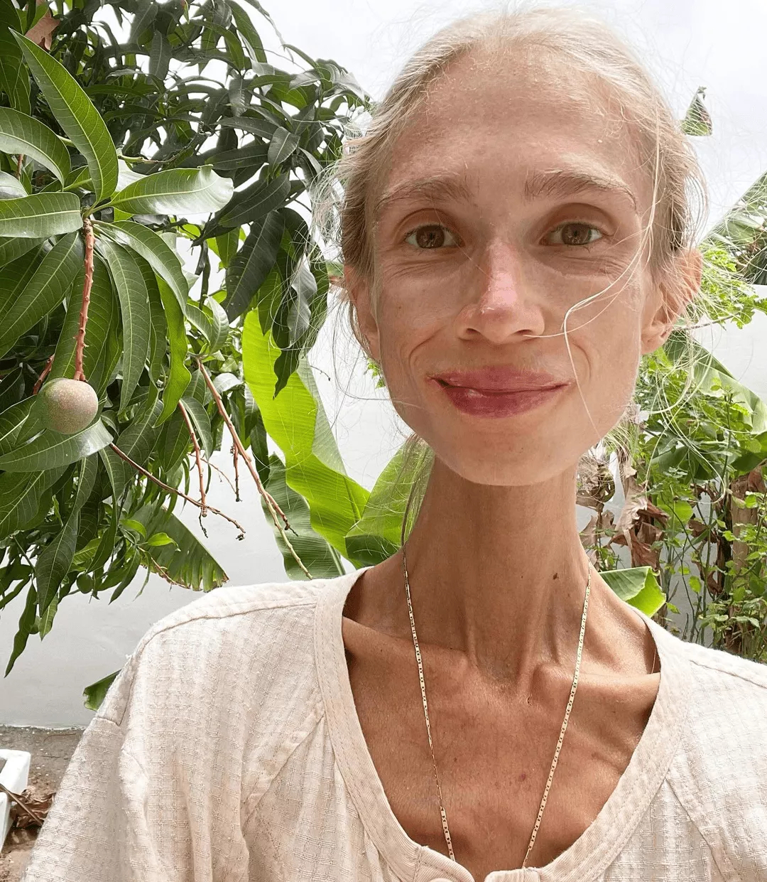 8 năm chỉ ăn trái cây, cô gái 27 tuổi qua đời: Sự thật được "phơi bày" - Ảnh 3. 8 năm chỉ ăn trái cây, cô gái 27 tuổi qua đời: Sự thật được "phơi bày" - Ảnh 3.