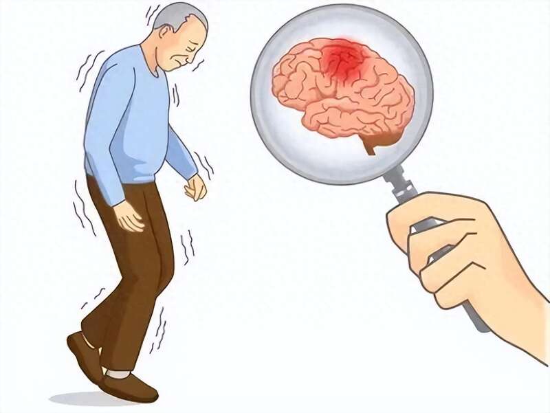 Hóa ra những người ít có nguy cơ bị đột quỵ khi về già thường có 3 thói quen này khi còn trẻ- Ảnh 1. Hóa ra những người ít có nguy cơ bị đột quỵ khi về già thường có 3 thói quen này khi còn trẻ- Ảnh 1.