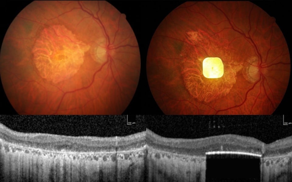 Vật thể chỉ 2mm làm nên điều kỳ diệu, giúp người mù đọc sách trở lại- Ảnh 2.