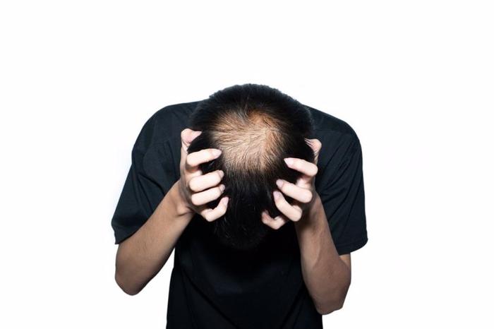 Người đàn ông 34 tuổi bị ngứa da đầu và qua đời sau 3 tháng: 4 cơn ngứa ngáy này xuất hiện thì có thể là bệnh nghiêm trọng hoặc ung thư- Ảnh 2.