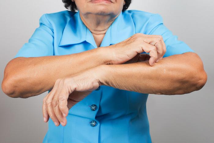 Người đàn ông 34 tuổi bị ngứa da đầu và qua đời sau 3 tháng: 4 cơn ngứa ngáy này xuất hiện thì có thể là bệnh nghiêm trọng hoặc ung thư- Ảnh 5.