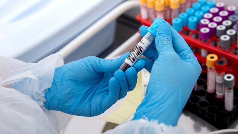 Đột phá y học: Xét nghiệm máu phát hiện UNG THƯ sớm đến 10 năm trước khi có triệu chứng Đột phá y học: Xét nghiệm máu phát hiện UNG THƯ sớm đến 10 năm trước khi có triệu chứng