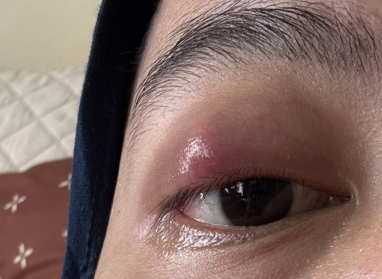 Phấn mắt PINKFLASH dính bê bối lớn: Người dùng bị lẹo mắt hàng loạt, hãng tiêu huỷ, đền tiền gấp đôi- Ảnh 4.