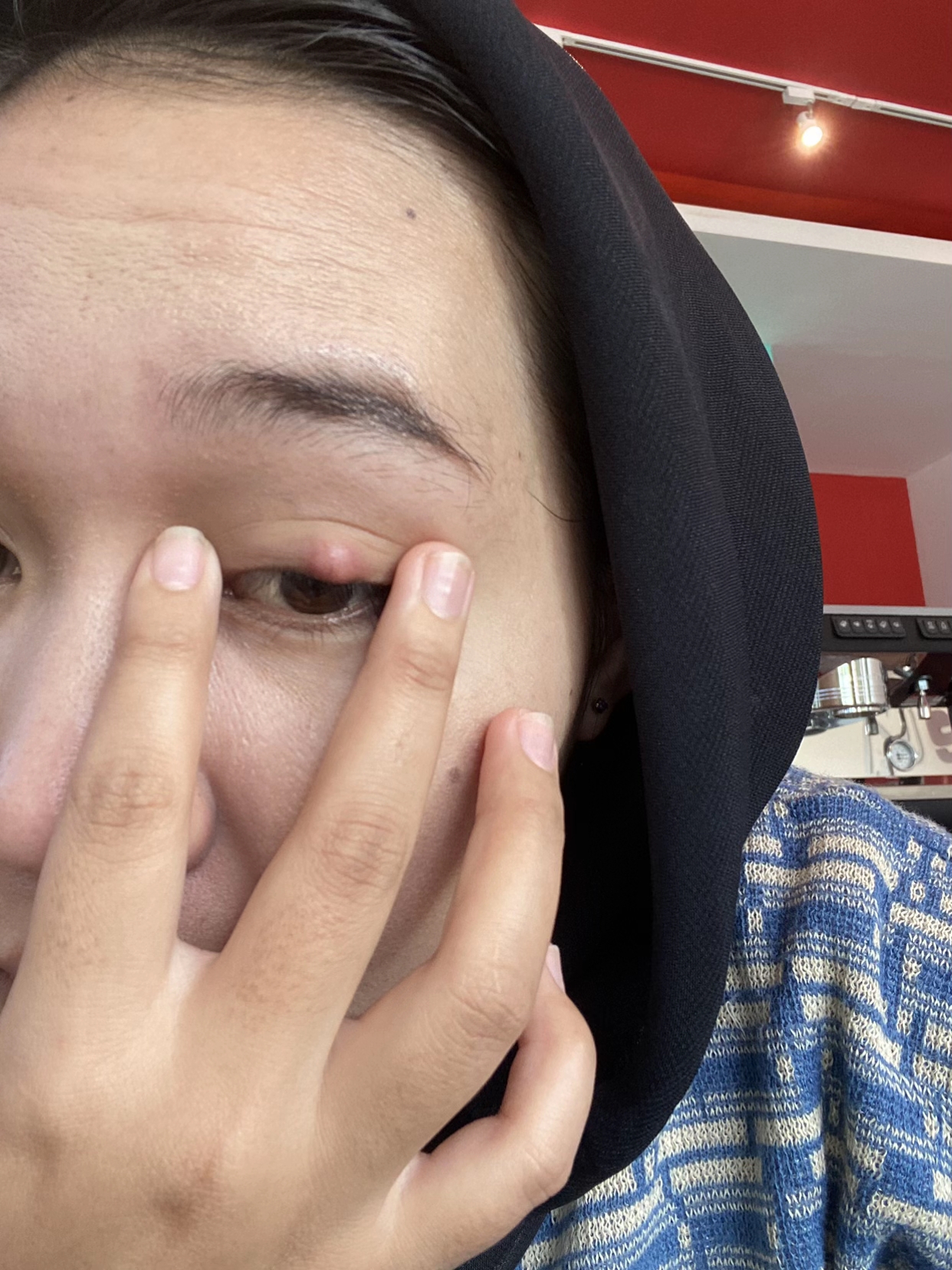 Phấn mắt PINKFLASH dính bê bối lớn: Người dùng bị lẹo mắt hàng loạt, hãng tiêu huỷ, đền tiền gấp đôi- Ảnh 2.