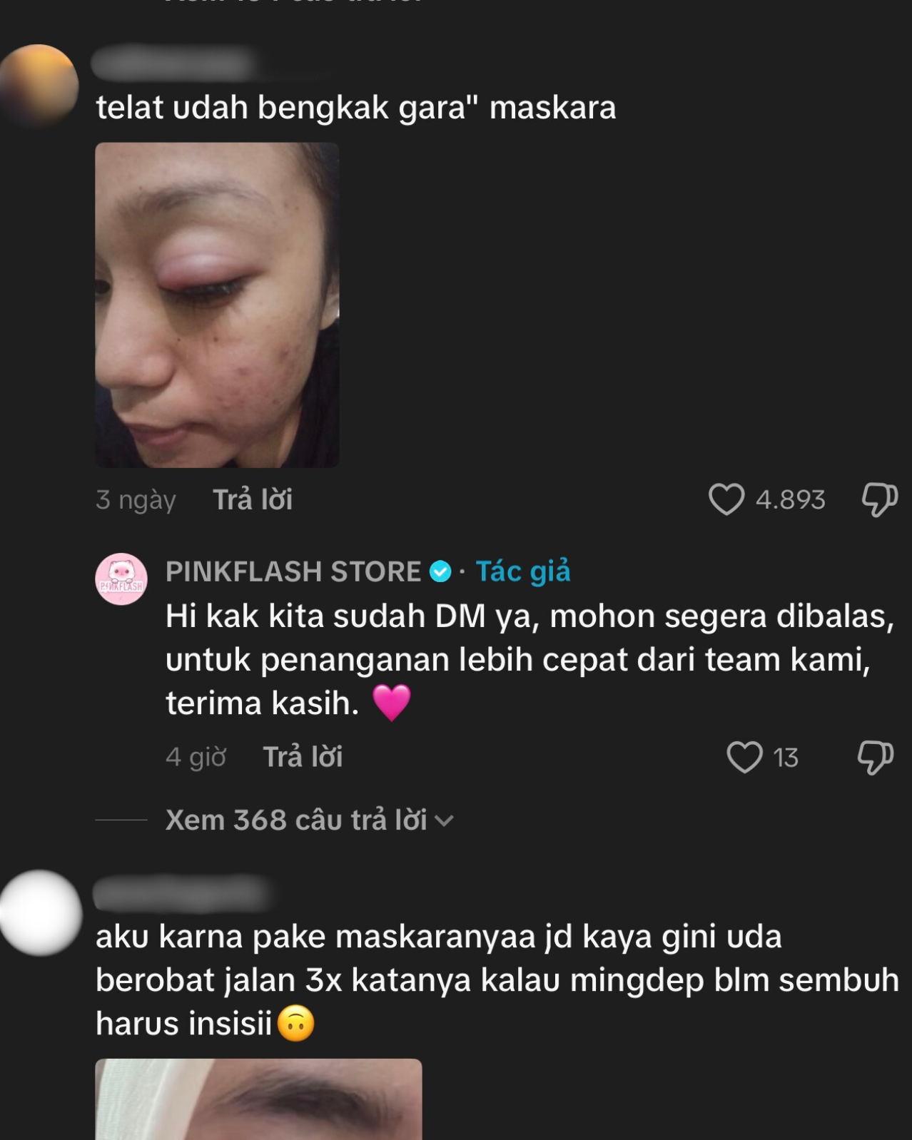 Phấn mắt PINKFLASH dính bê bối lớn: Người dùng bị lẹo mắt hàng loạt, hãng tiêu huỷ, đền tiền gấp đôi- Ảnh 11.