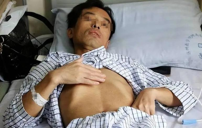 Người đàn ông 53 tuổi mắc ung thư gan, bác sĩ tức giận: Đừng làm việc này quá 3 lần 1 tháng